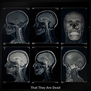 16K views · 330 reactions | The Cotard Delusion -The Terrifying Neurological Belief That One is Already Dead | Thehiddenfact4u | Facebook