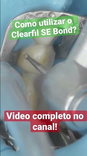 COMO UTILIZAR O CLEARFIL SE BOND? - #odontologia #dentista #shorts