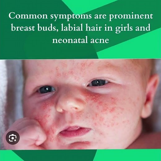 Understanding Mini Puberty in Newborns: Hormonal Changes in Infancy