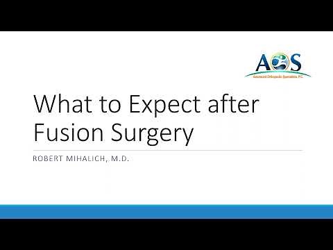 What to Expect When Undergoing a Fusion Procedure in the Foot or Ankle
