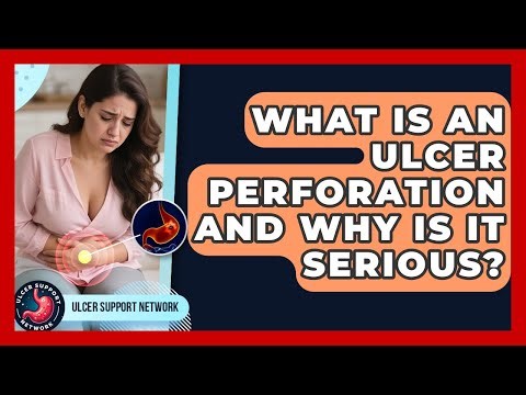 What Is An Ulcer Perforation And Why Is It Serious? - Ulcer Support Network