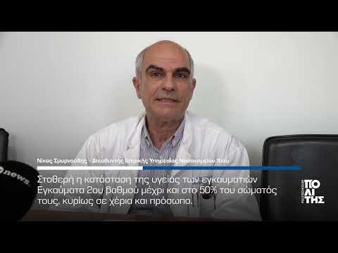 Νίκος Σμυρνιούδης - Ελεγχόμενη η κατάσταση των εγκαυματιών