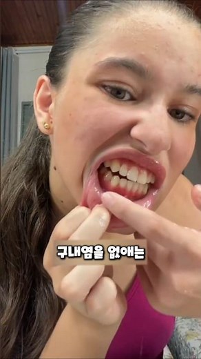 따라하면 큰 일 나는 구내염 없애는 민간요법