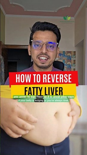 How to Reverse Fatty Liver Naturally: 5 Detox Drinks to Cleanse Your Liver Fast