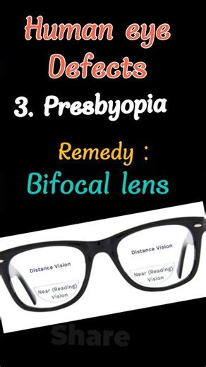 Human Eye Defects, #presbyopia,