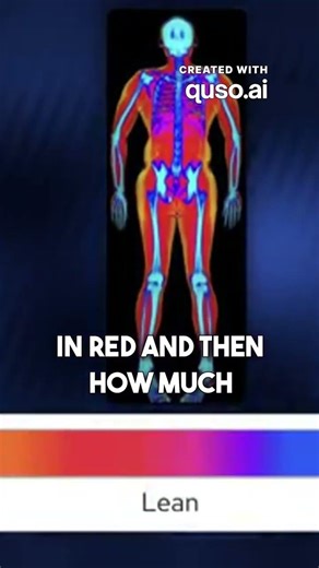 dexa scan reveals visceral fat #earbuds #tech #macbooklcd #technology