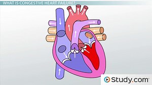Heart Failure: The Left Heart, Lungs, & Etiology