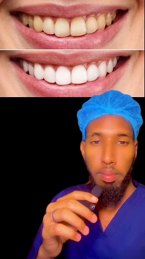 Effective Teeth Whitening with Mi Paste: A Review by Dr. Cadaan