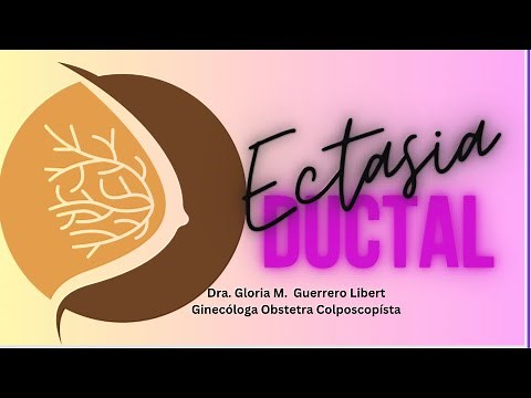 ¿Que es la Ectasia Ductal?
