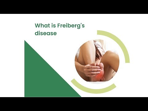 What is Freiberg's disease?