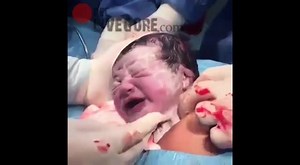 Doctor Performing Surgery To Pregnent Woman