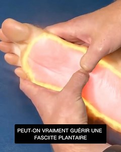 Vous ressentez une piqûre au talon le matin ? Attention : la fasciite plantaire ne disparaît pas toute seule. Si ça empire, les douleurs peuvent devenir chroniques et vous empêcher de marcher normalement. Des milliers de personnes ont déjà trouvé un soulagement rapide grâce à Vital : le seul soutien intelligent pour la voûte plantaire. Ne laissez pas l’inflammation s’installer. Essayez Vital et retrouvez le plaisir de marcher ! https://www.santellia.com/products/vital | Santéllia