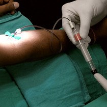 Video: Characterization of Leukocyte-platelet Rich Fibrin, A Novel Biomaterial