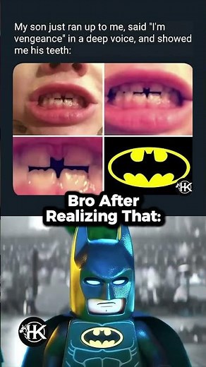 His teeth look like batman logo 🦇