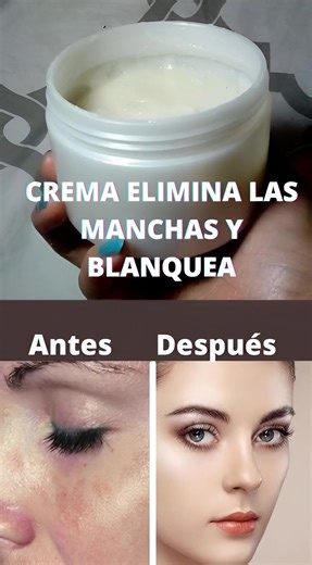 🤍 Crema COREANA CASERA para BLANQUEAR la piel y quitar las MANCHAS de la CARA 🤍 Si buscas una piel más suave, luminosa y sin manchas, esta crema casera estilo coreano te encantará 😍✨. Mezcla gel de sábila, arroz licuado y unas gotas de aceite de vitamina E. Aplícala en tu rostro limpio cada noche y déjala actuar 20 minutos. Notarás tu piel más clara, hidratada y radiante con el uso constante 🌸💧. Es una opción natural, económica y hecha en casa 🏡✨. ⚠️ Advertencia: Antes de probar cualquier 