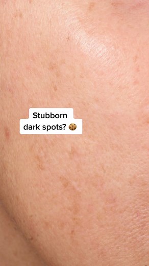 Fade dark spots & discoloration with CLINICAL Discoloration Repair Serum 🔧 #PaulasChoice #AcneMarks #SkincareTikTok #Serum #UnevenTone #Fyp