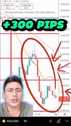 +300 pips Gold Price Prediction, Signal, Chart Analysis