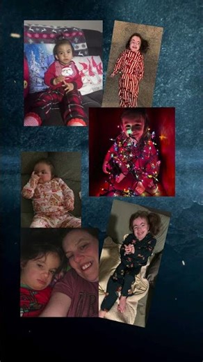 Trisomy 18 is rare..