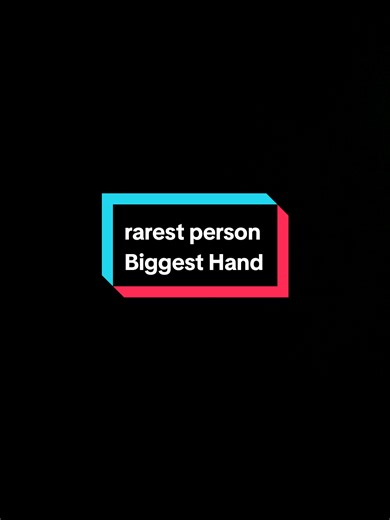Discover the Mystery of the Biggest Hand in Humans