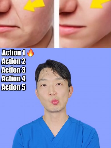 팔자주름 고민 해결을 위한 1주일 프로그램