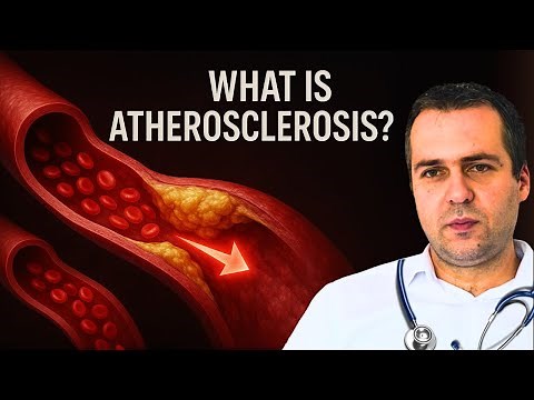 Atherosclerosis: Causes, Symptoms, Treatment & Prevention