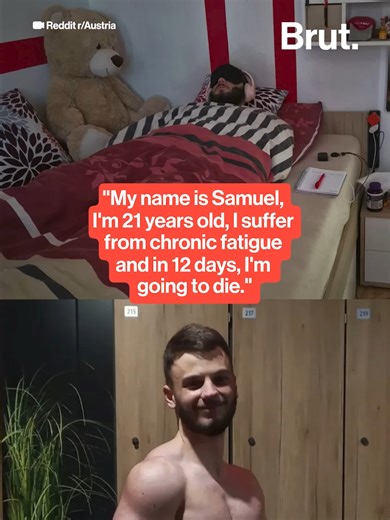 Austrian Young Man Raises Awareness For Chronic Fatigue Syndrome