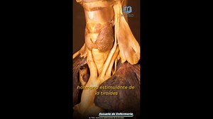 La glándula tiroides es como la “central eléctrica” del cuerpo 🤓⚡. Te cuento en corto y bonito: 📍 Ubicación: está en el cuello, justo debajo de la nuez de Adán, abrazando la tráquea con forma de mariposa 🦋. ⚙️ Función principal: produce hormonas (T3 y T4) que regulan el metabolismo, es decir, la velocidad con la que el cuerpo usa la energía. Por eso influye en el peso, la temperatura, el corazón, el ánimo y hasta el cabello. 🔧 Hormona aliada: la TSH (hormona estimulante de la tiroides), prod