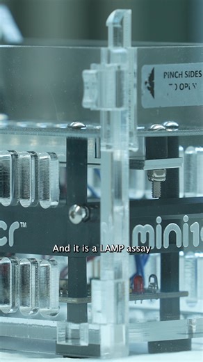 Malaria is not just an international threat; it must also continue to be addressed here in the U.S. There are nearly 2,000 cases of malaria reported in the U.S. each year, mostly due to international travel. Thanks to a test created by CDC experts & Public Health Entomology for All (PHEFA) interns, we can better control malaria across the globe & in the U.S. Watch to see how ⬇️ https://bit.ly/3RAjkVk | CDC