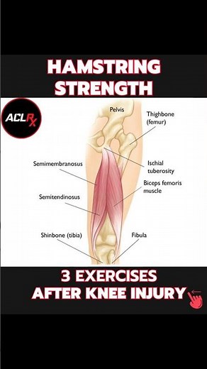 Hamstring Strengthening Exercises after Knee & ACL Injury