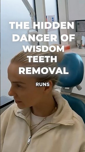 Watch This Before Removing Your Wisdom Teeth! #dentist #wisdomtoothextraction #nervedamage
