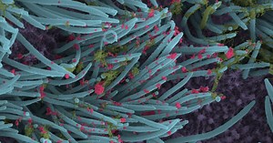 Scientists produce images showing COVID-19's spread and impact on lung cells