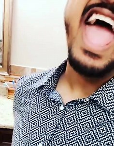 32K views · 623 reactions | These Snapchat filters are toooo wild. | Mohan | Facebook