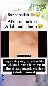 Beginilah yang terjadi ketika sel darah putih bertemu b4kteri yang masuk kedalam tubuh manusi4 #reels #fyp #viral #trending #reelsfyp #reelsviral #reelstrending #reelsmeledak #monetisasi #facebook #bonuskinerja #jangkauanluas | Nurul Qomariyah