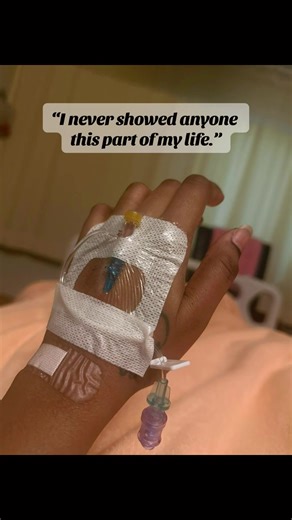 My Journey Through Slip Disc Surgery: A New Beginning