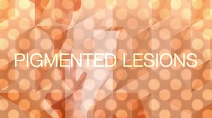 SPLENDOR X by Lumenis introduces BLEND X Technology