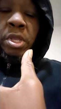 muscle atrophy in hands