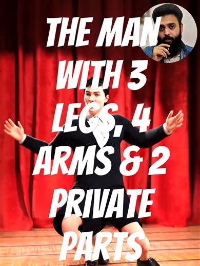 The Man with 3 Legs, 4 Arms & 2 Private Parts – Shocking Facts Explained #facts #shocking #shorts