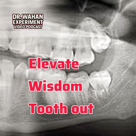 Elevate this Wisdom Tooth Out
