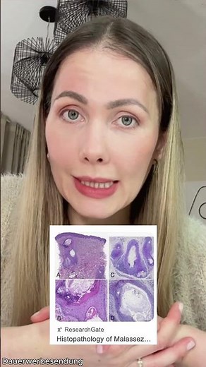 Blemished skin? Why you can't tolerate ANY skincare products... (Small, tiny pimples)