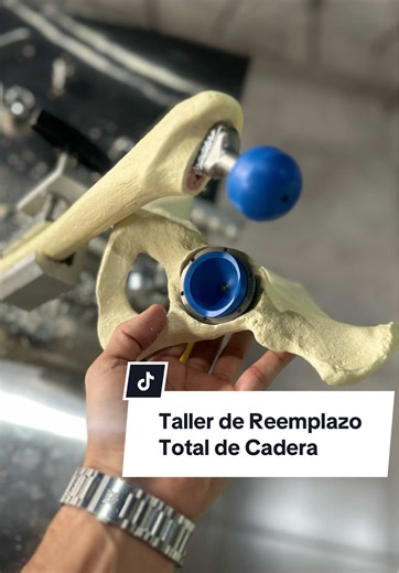 Talleres de Reemplazo Total de Cadera para Médicos