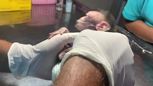 Baby Monkey Medical | monkey