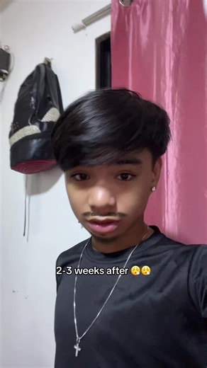 Getting a Bad Haircut vs. 2-3 Weeks After: The Transformation