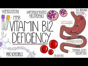 Vitamin B12 Deficiency Explained Clearly