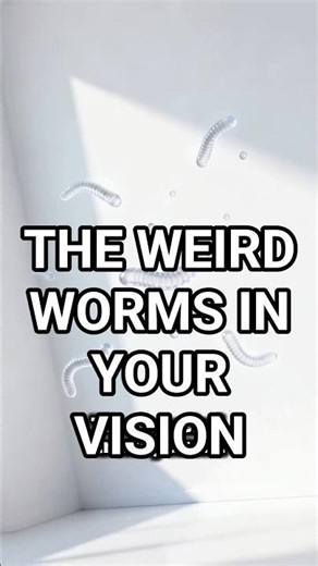 Are The Floaters In Your Eyes Parasites? 😳