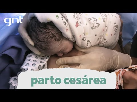 Parto cesárea: gravidez natural após tentativa de fertilização | Partos Emocionantes | Boas Vindas