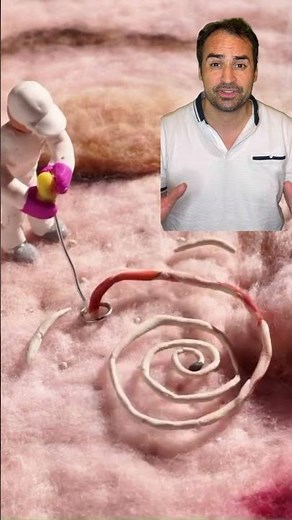 Biggest blackhead ever #footlessstudio #skincare !