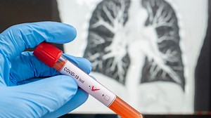 Negative antibody test? It doesn't mean you haven’t had coronavirus, say experts