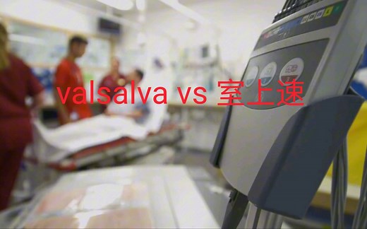 柳叶刀 valsalva vs 室上速 标准瓦式动作体位调整治疗室上速