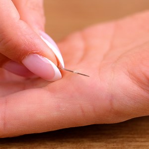 Stuck splinter gets removed easily | MetDaan Creative