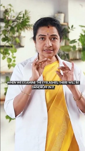 How to get rid off Dandruff in eyebrows #eyecare